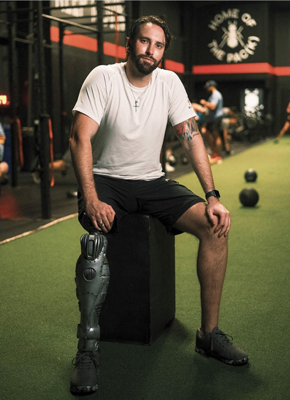A person of light skin tone sitting. They are wearing a white tshirt and black shorts and have a prosthetic right leg.