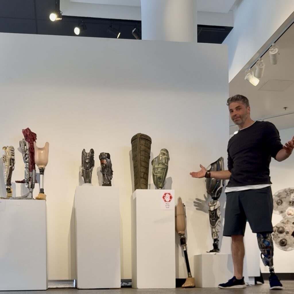 A man stands in a gallery space beside a display of prosthetic leg covers arranged on white pedestals. Each cover is uniquely designed with sculptural and artistic details. The man, wearing a black shirt and shorts, gestures with open arms while wearing one of the decorated prosthetic legs himself.